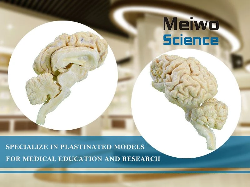 Plasticized Plastinated Brain Hemispheres Of Cow