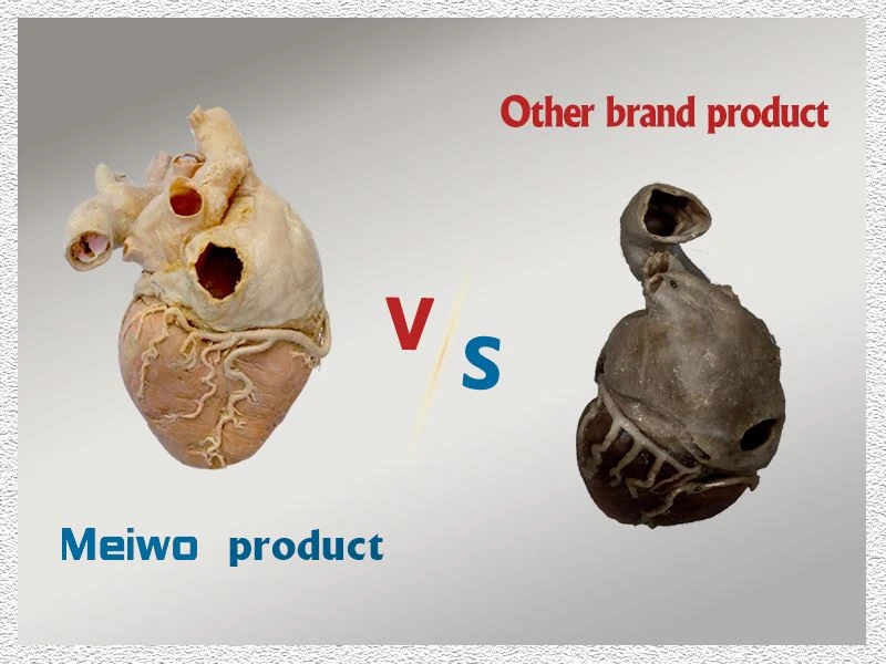 Quality Comparison